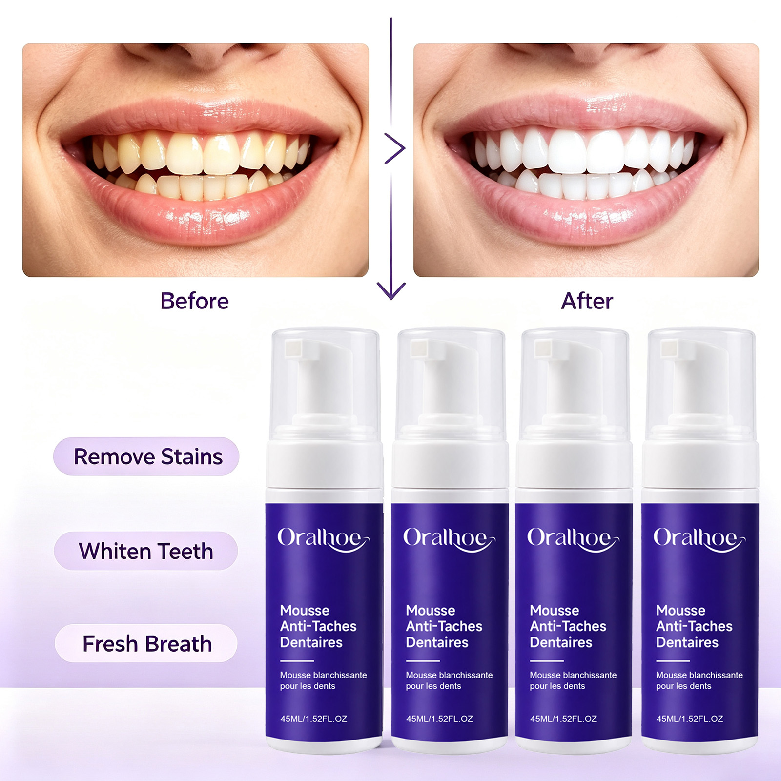 Teeth Whitening Routine - Pasta Gigi Pemutih Gigi Berbusa Ungu