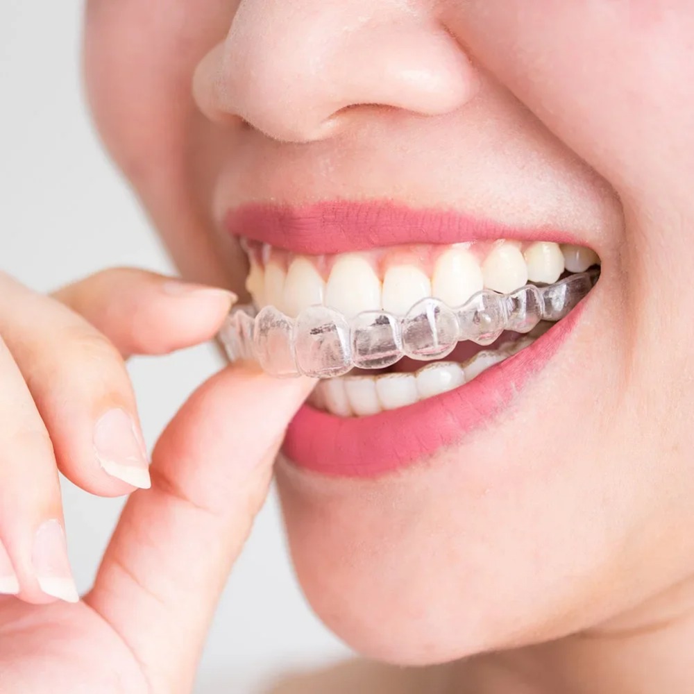 1-4Pc Pelindung Mulut Anti Men - Dental Guard Night ulasan dan harga