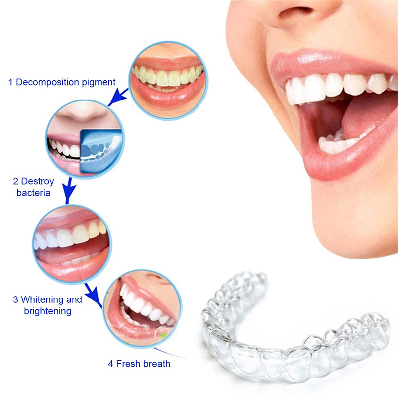 Pelindung Gigi Silikon Nyaman  - Teeth Whitening Mouth Guard ulasan dan harga