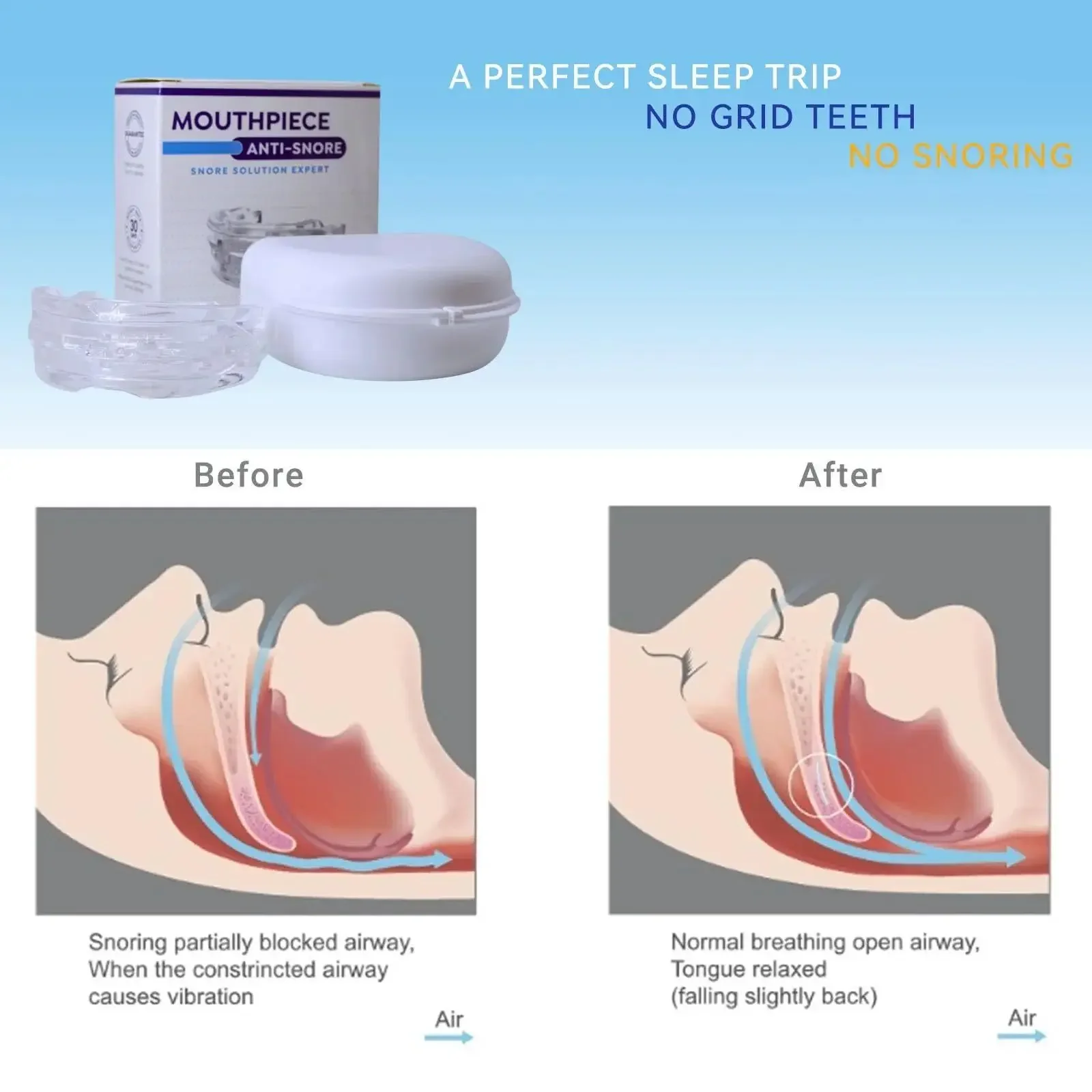 Penyangga Mulut Anti-Dengkuran - Dental Guard Night ulasan dan harga