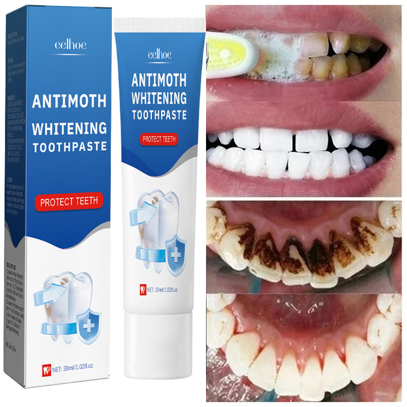 Cepat Menghilangkan Noda Asap  - Teeth Whitening Fast ulasan dan harga