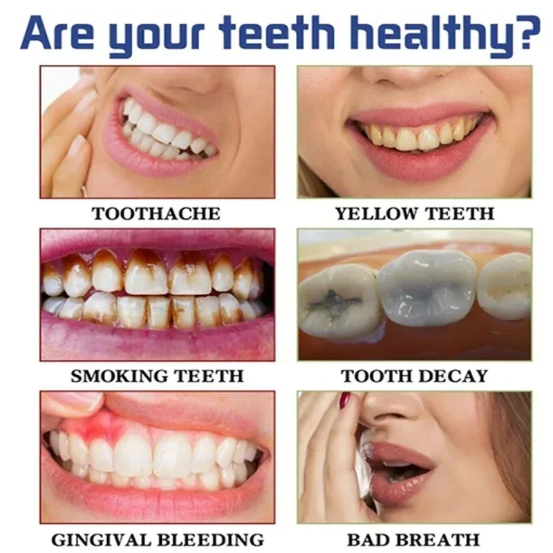 Cepat Menghilangkan Noda Asap  - Teeth Whitening Fast ulasan dan harga