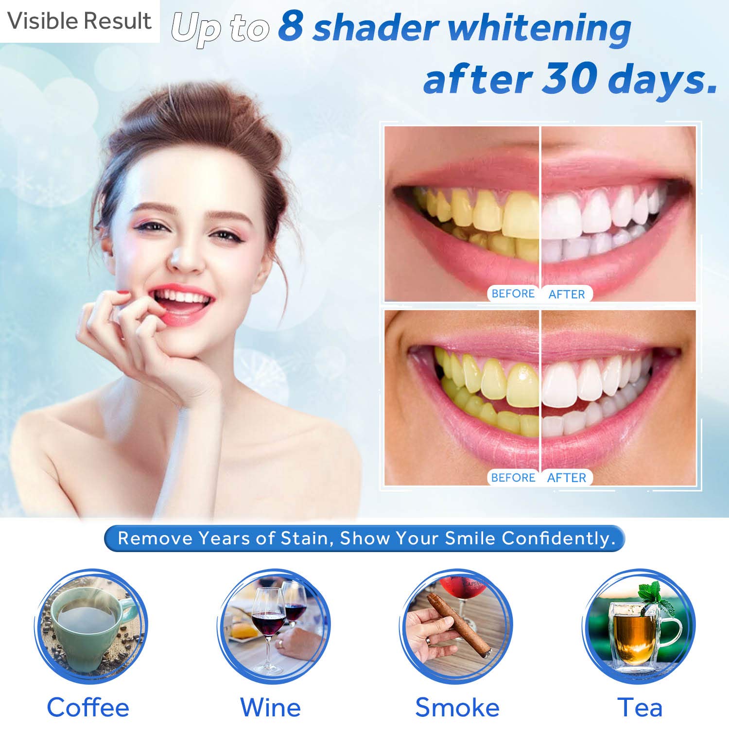 Gel Pemutih Gigi Isi Ulang Syr - Teeth Whitening Mouth Guard ulasan dan harga