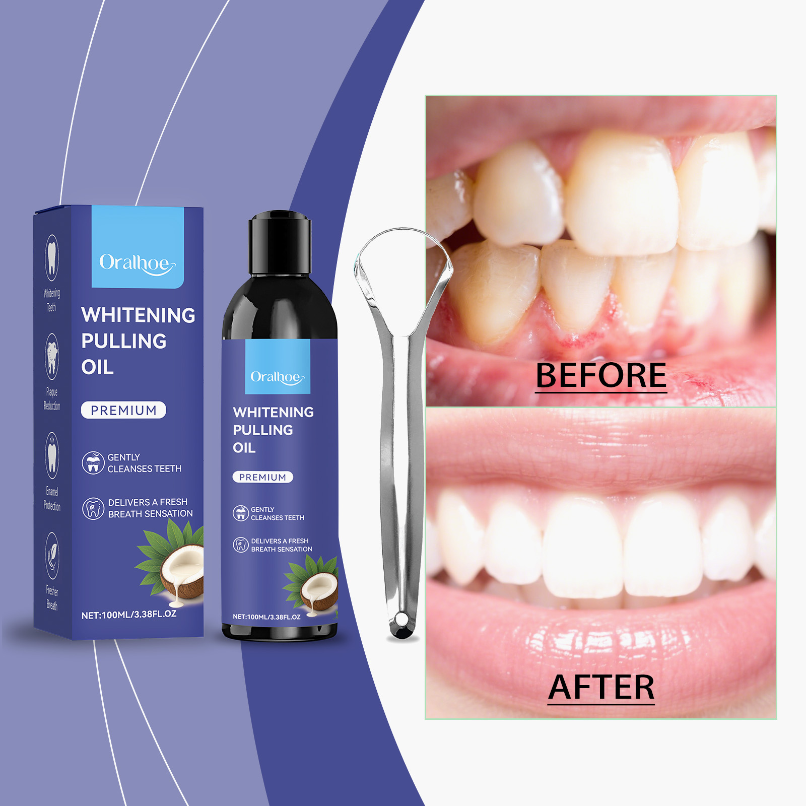 Obat Kumur Minyak Kelapa Peppe - Teeth Whitening With Coconut Oil ulasan dan harga