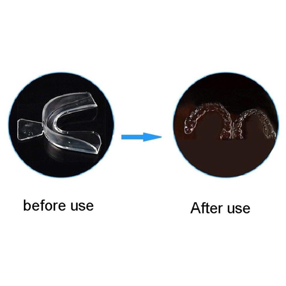 Pelindung Mulut Silikon Ortodo - Teeth Whitening Mouth Guard ulasan dan harga