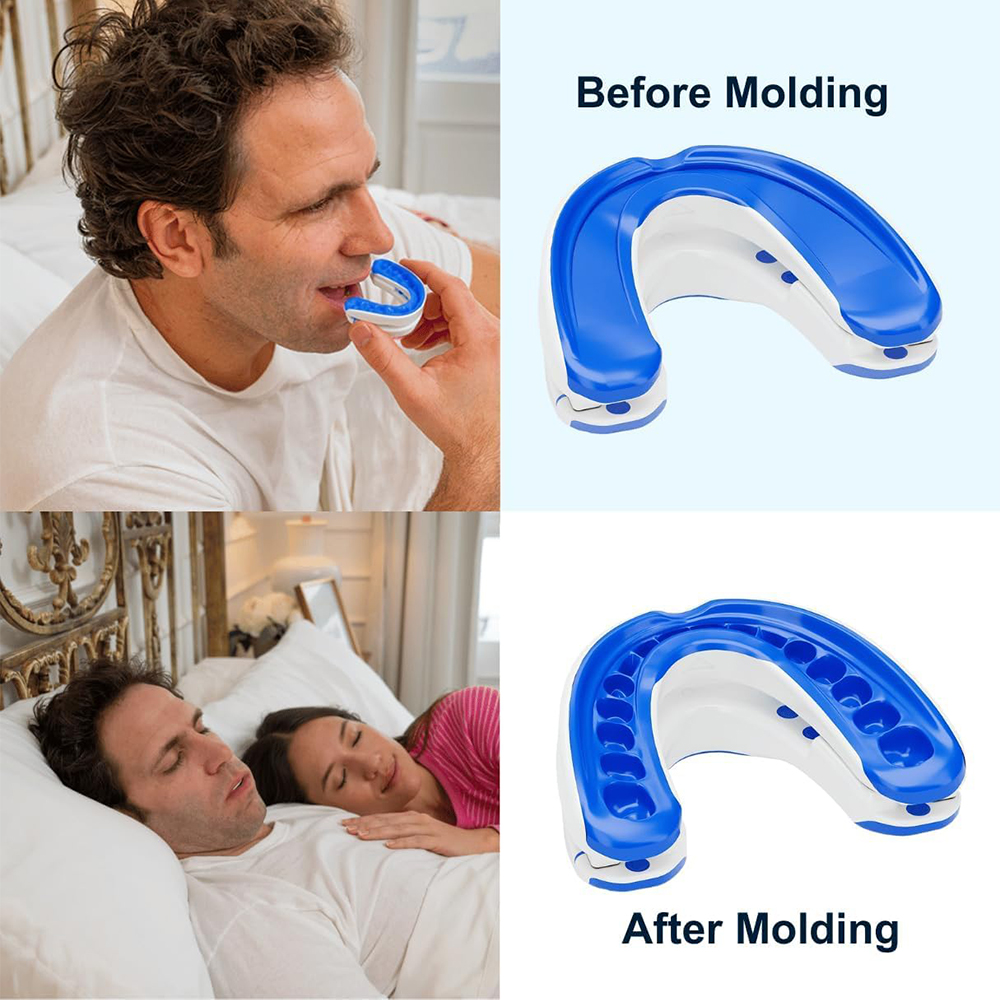 Pelindung mulut Anti mendengku - Dental Guard Night ulasan dan harga