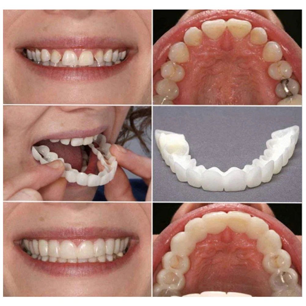 Gigi palsu perawatan pria dan  - Teeth Whitening Mouth Guard ulasan dan harga